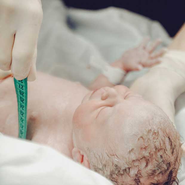 A newborn baby's appearance after birth - covered in vernix