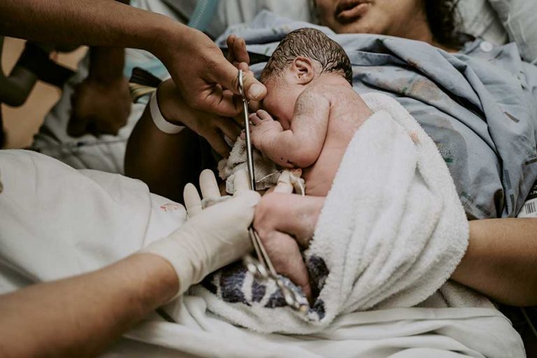 Labour Intervention About Episiotomy and Forceps or Ventouse Delivery