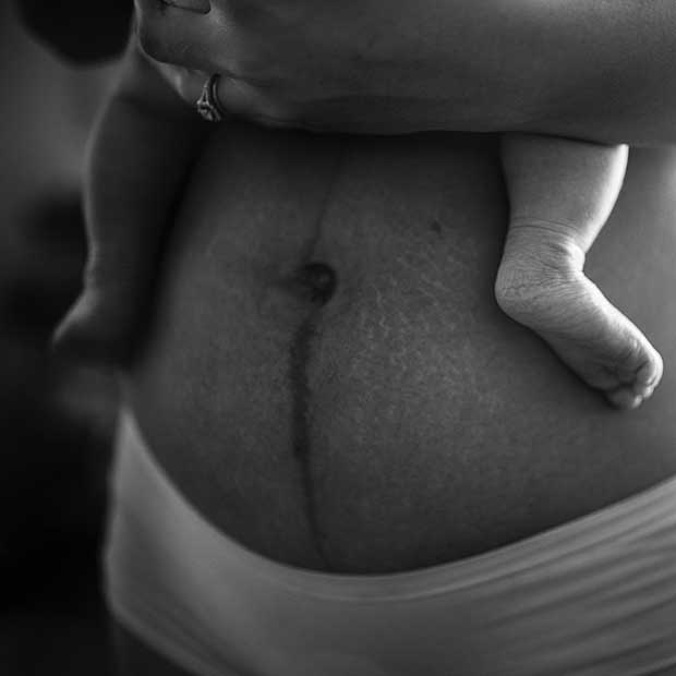 Postpartum mum with linea nigra holds newborn baby on belly
