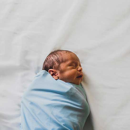Jaundice is common in newborn babies