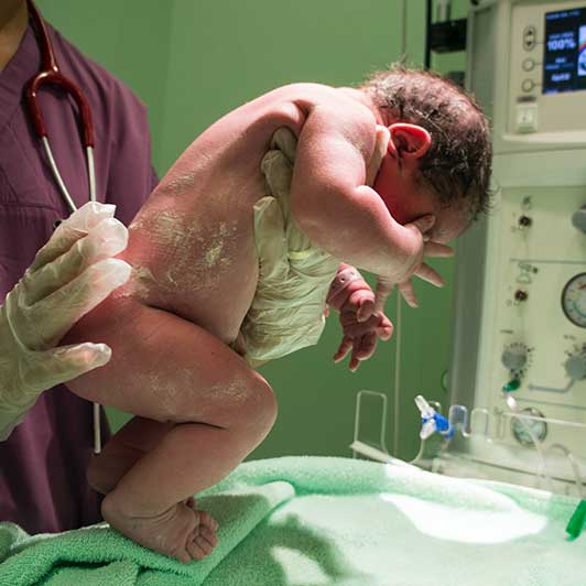 Newborn baby coated in vernix